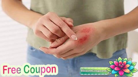 100% Free Coupon Beyond the Burn: Comprehensive Burn Care Strategies